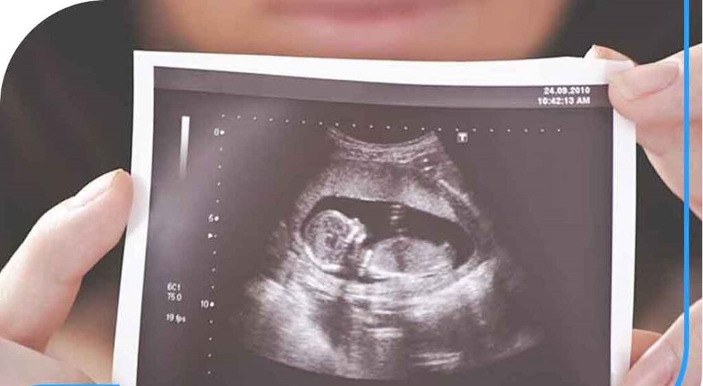 هفته ۳۲ بارداری