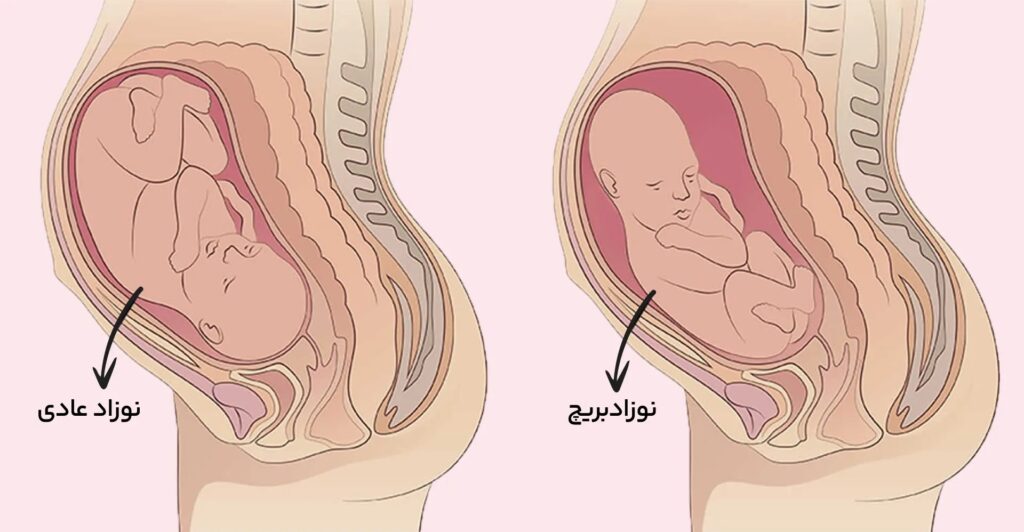 هفته سی و ششم حاملگی