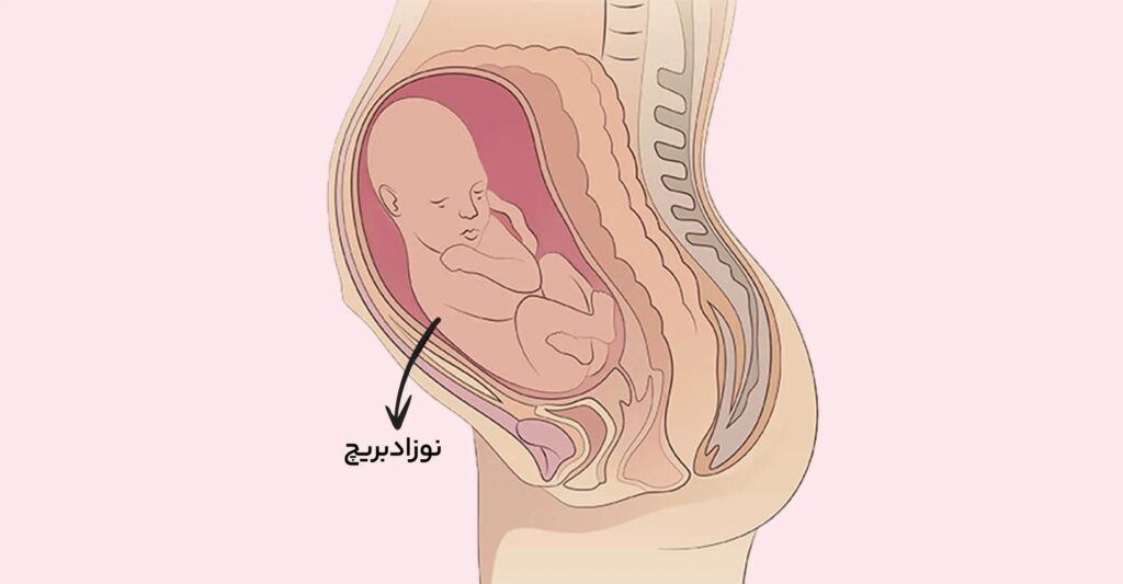 هفته سی و هشتم حاملگی